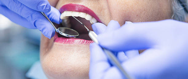 Best Emergency Treatment for Dental Infections or Abscesses in Omaha, TX